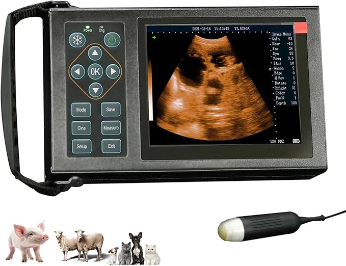 Portable Traveling Ultrasound Tech Machine for Pregnancy